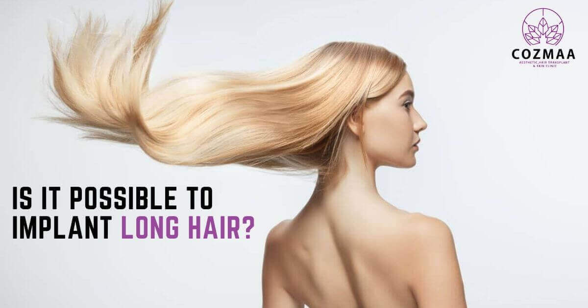 Is It Possible To Implant Long Hair?