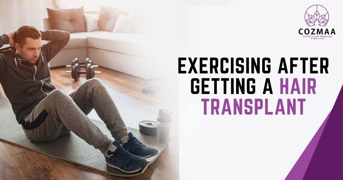 When You Start Exercising After Getting a Hair Transplant?