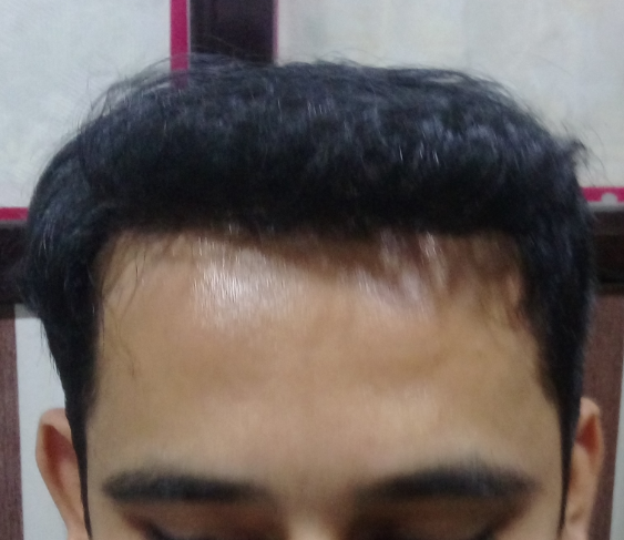 After