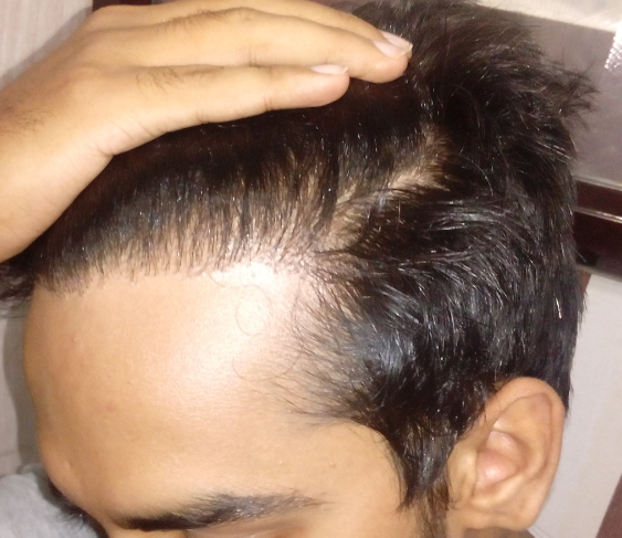 After