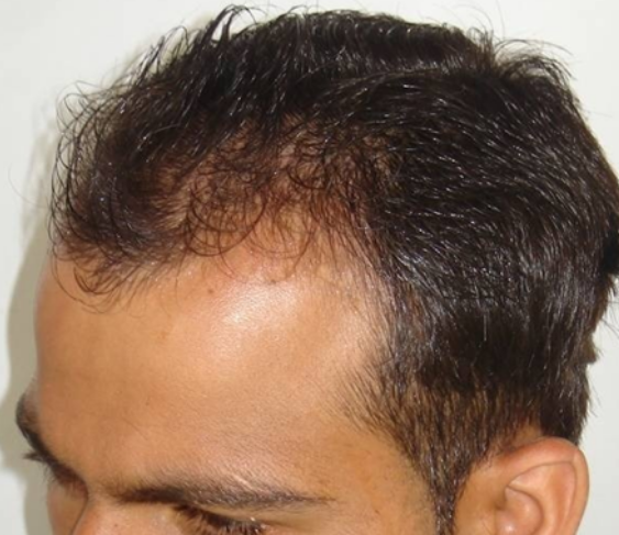 Before